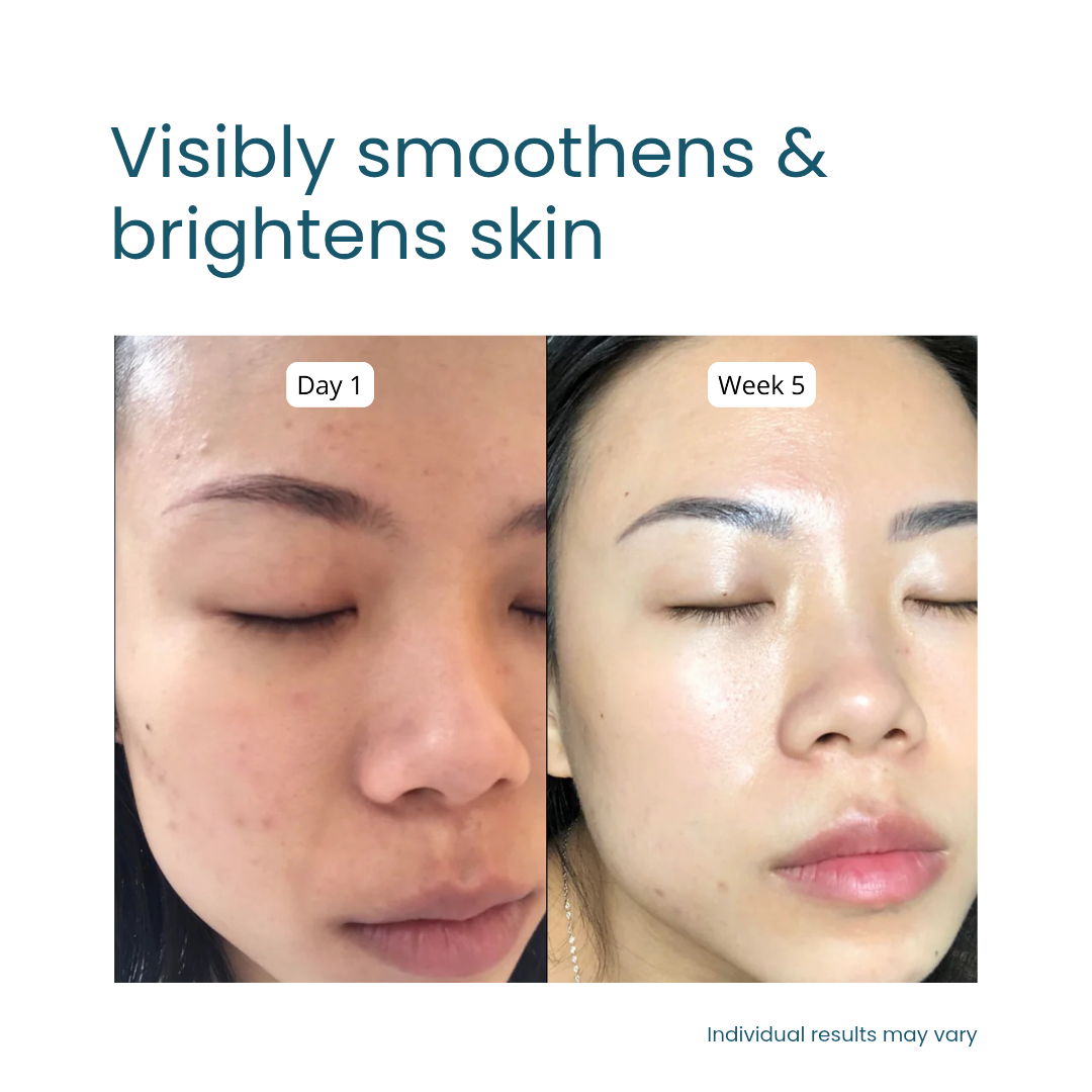 Anti-aging jelly with eggshell membrane supplement