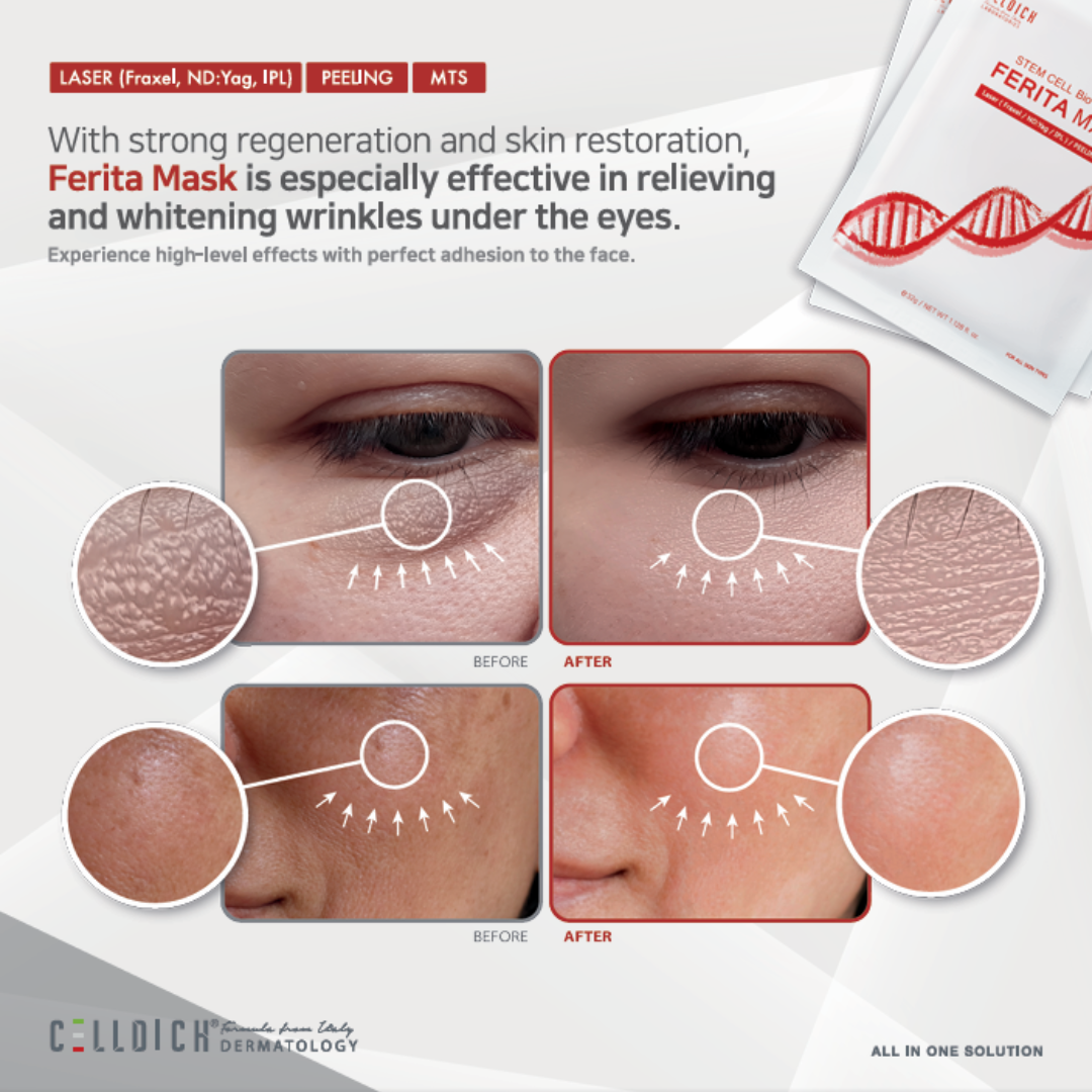 Celldich FERITA Stem Cell Mask 10 Sheets/Box